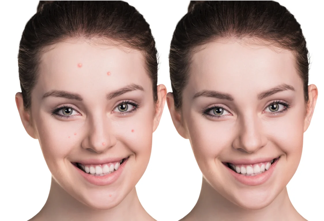 Steps to Procedure Photo Retouching-2  | Vertical Clipping